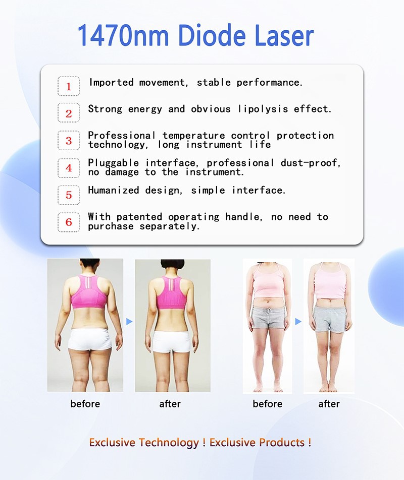1470nm-lipolysis-diode-laser-machine 1470nm-lipolysis-diode-laser-machine