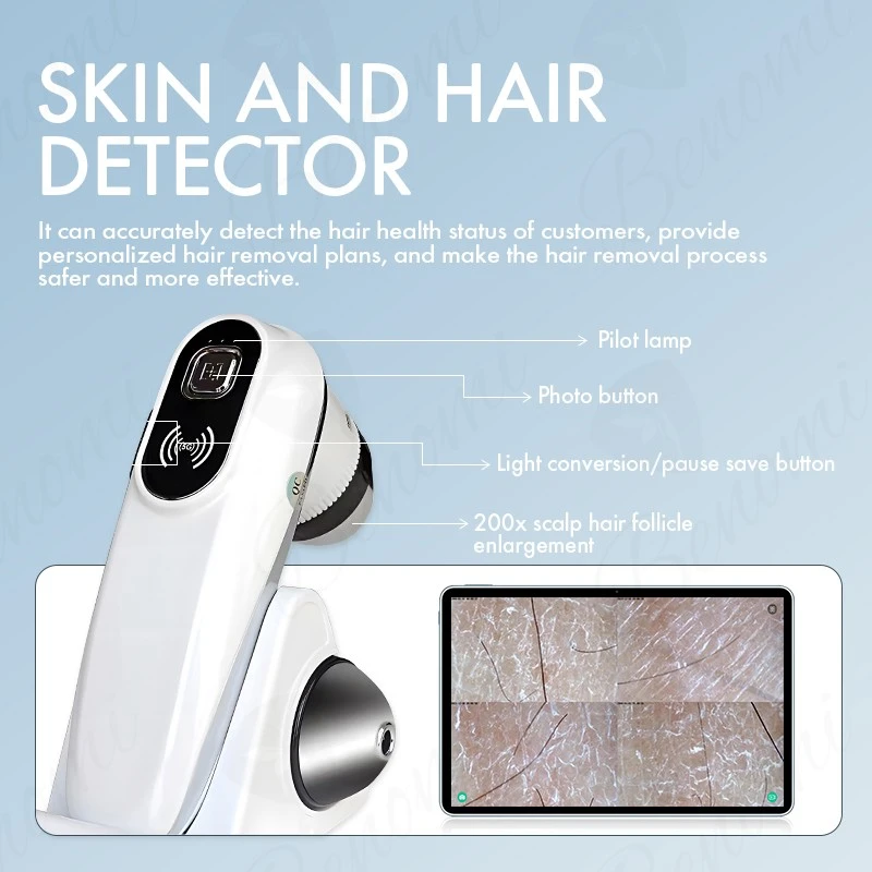 Beauty Machine Soprano Ice Laser Hair Removal suppliers