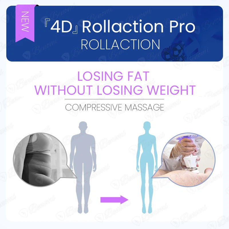 Best 4D Fat Blasting Machine manufacturers